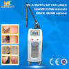 চীন Professional q switched nd yag laser tattoo removal machine with best result কারখানা