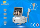 চীন Professional High Intensity Focused Ultrasound Hifu Machine For Face Lift কারখানা